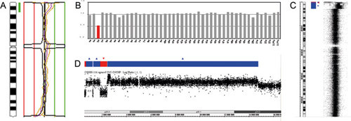 Figur 5  Ved kromosombasert HR-CGH-analyse av DNA fra en pasient med klinisk mistanke om et sjeldent syndrom ble en&hellip;