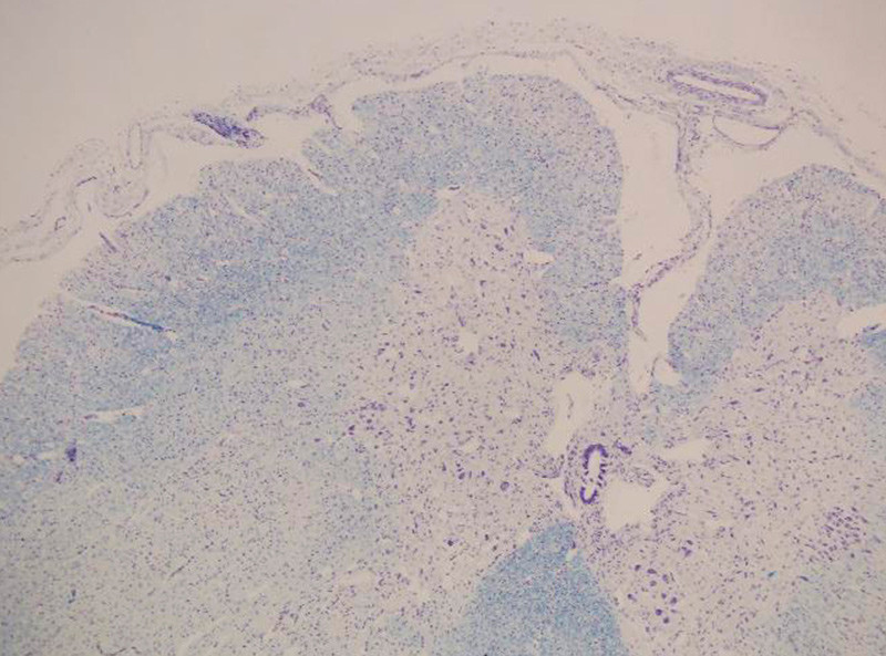Figure 2  Medulla spinalis, thin anterior root (top left). Photo David Scheie