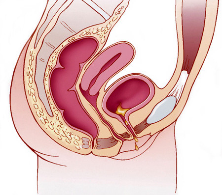 Illustrasjonsfoto Science Photo/ NTB scanpix