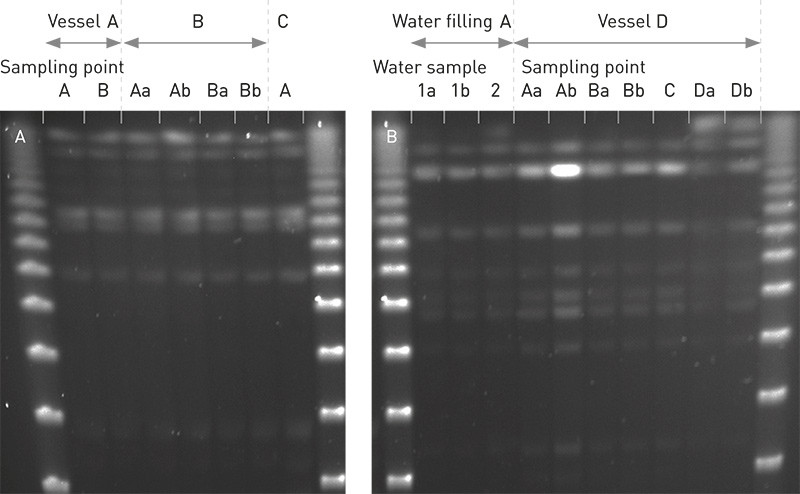 Figure 1  a) Genotype pattern of L. pneumophila isolated from three different vessels in the same class. b) Genotype pattern&hellip;