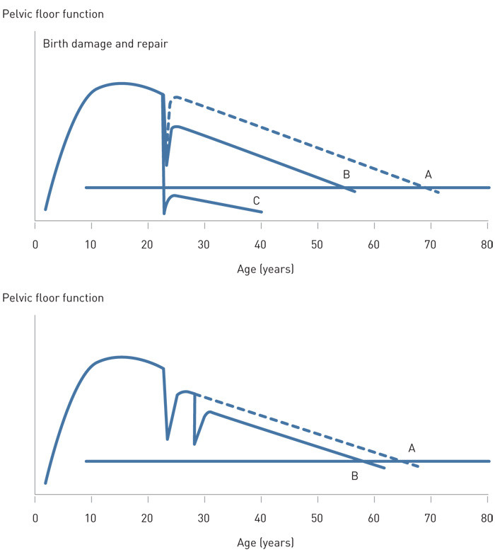Figure 3  Variations in birth damage and repair. In the upper section of the figure we see that a birth that does not damage&hellip;