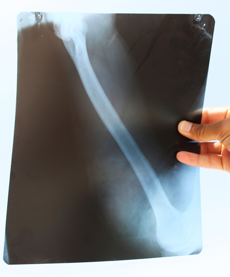 Illustrasjonsfoto: Ton Koene/NTB scanpix