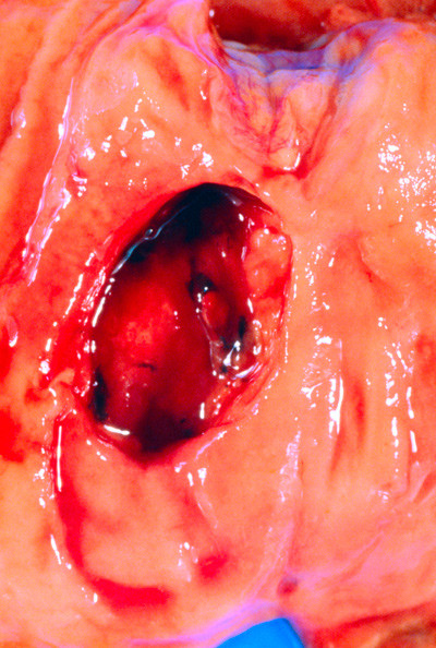 llustrasjonsfoto: Science Photo Library/NTB scanpix