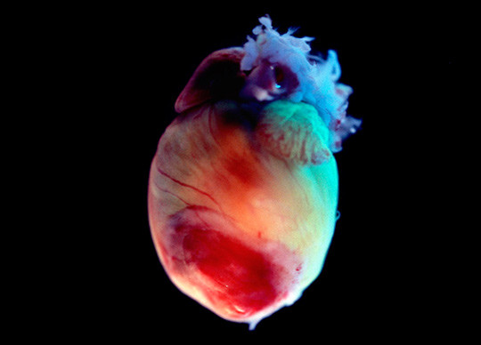 Foto: Sciencephoto/NTB Scanpix