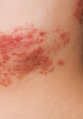 Illustrasjonsfoto: Thinkstockphoto