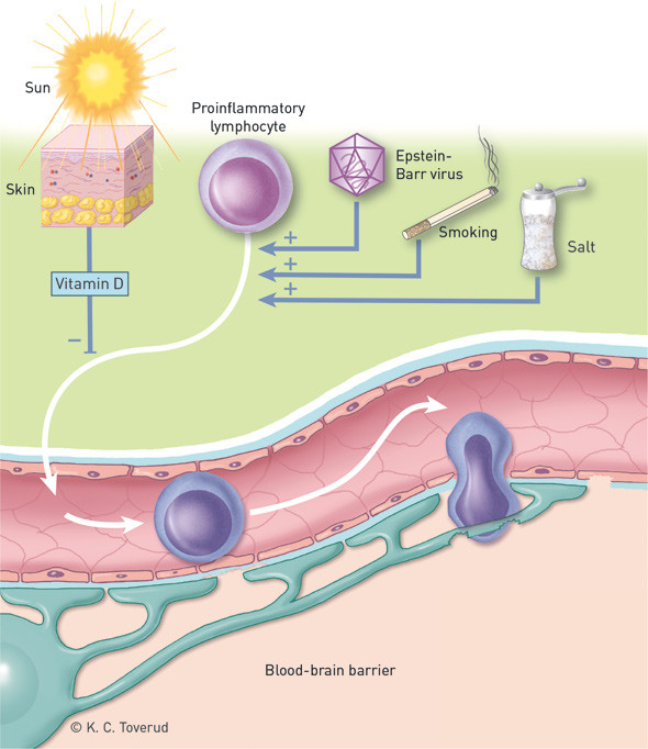 Figure 1  A simplified overview of Epstein-Barr virus, smoking and vitamin D as environmental factors in the development of&hellip;