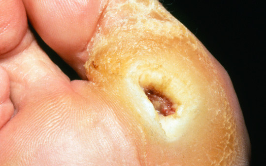 Illustrasjonsfoto: Science Photo Library/NTB scanpix