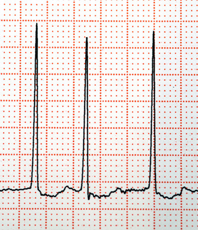 Illustrasjonsfoto: Science photo/NTB scanpix