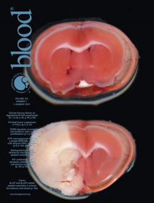 Studien ble publisert i det prestisjetunge tidsskriftet Blood i januar 2015