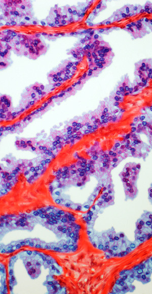 Illustrasjonsfoto: Science Photo Library