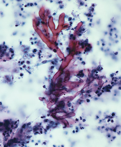 Illustrasjonsfoto: Science Photo Library