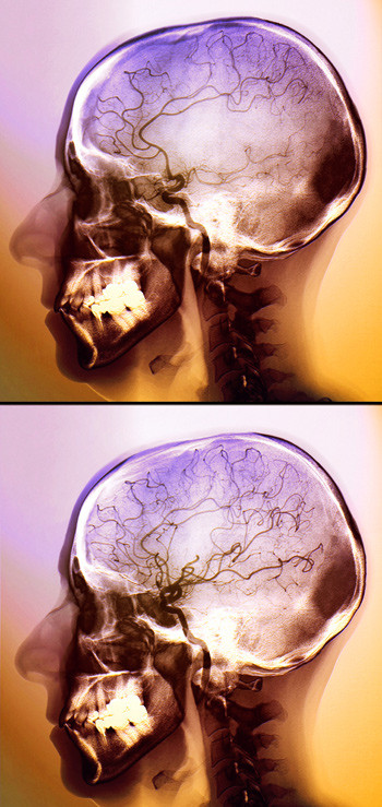 Illustrasjonsfoto: Science Photo Library