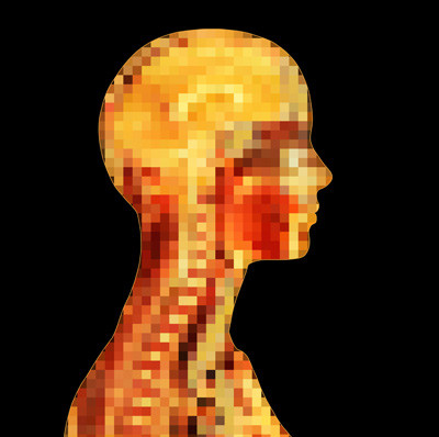 Illustrasjonsfoto: Science Photo Library