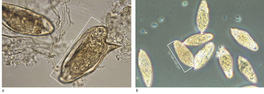 Figure 2  Eggs of a) S. mansoni and b) S. haematobium