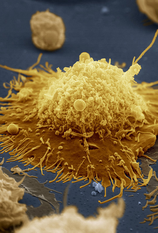 Illustrasjonsfoto: Science Photo Library