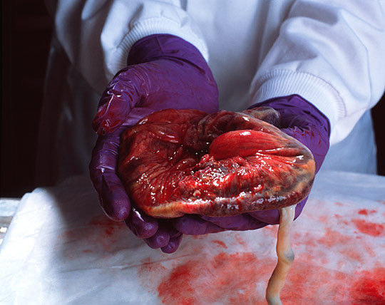 Illustrasjonsfoto: Science Photo Library