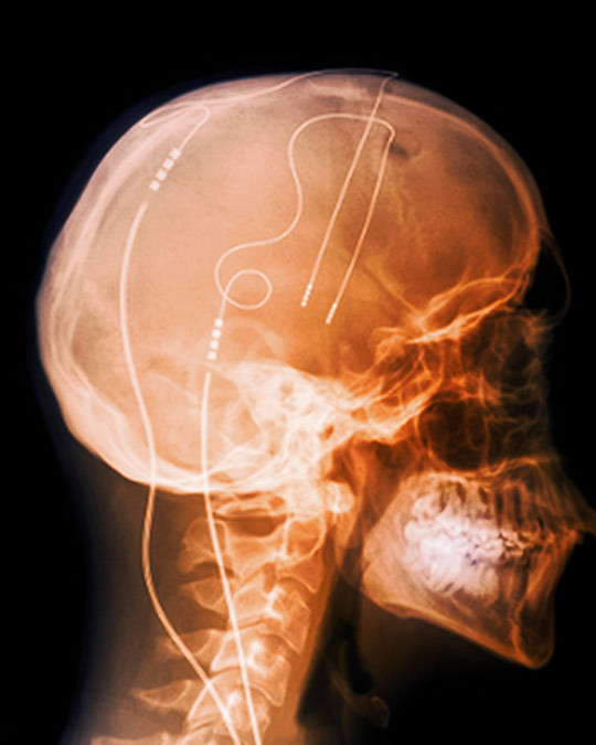 Illustrasjonsfoto: Science Photo Library