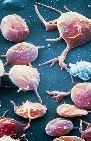 Illustrasjonsfoto: Science Photo Library