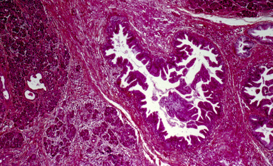 Illustrasjonsfoto: Science Photo Library