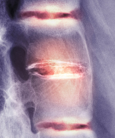 Illustrasjonsfoto: Science Photo Library