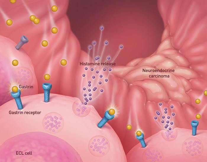 A fall in acidity triggers the release of gastrin, which stimulates ECL cells to release histamine. Gastrin also stimulates&hellip;