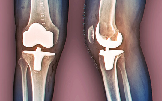 Illustrasjonsfoto: Science Photo Library