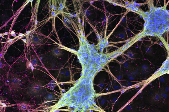 Illustrasjonsfoto: Science Photo Library