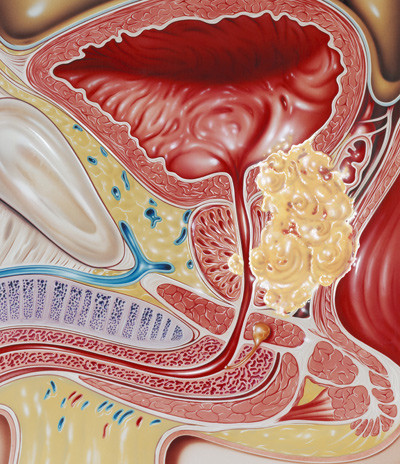 Illustrasjonsfoto: Science Photo Library