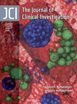 Artikkelen ble publisert i Journal of Clinical Investigation i august 2015