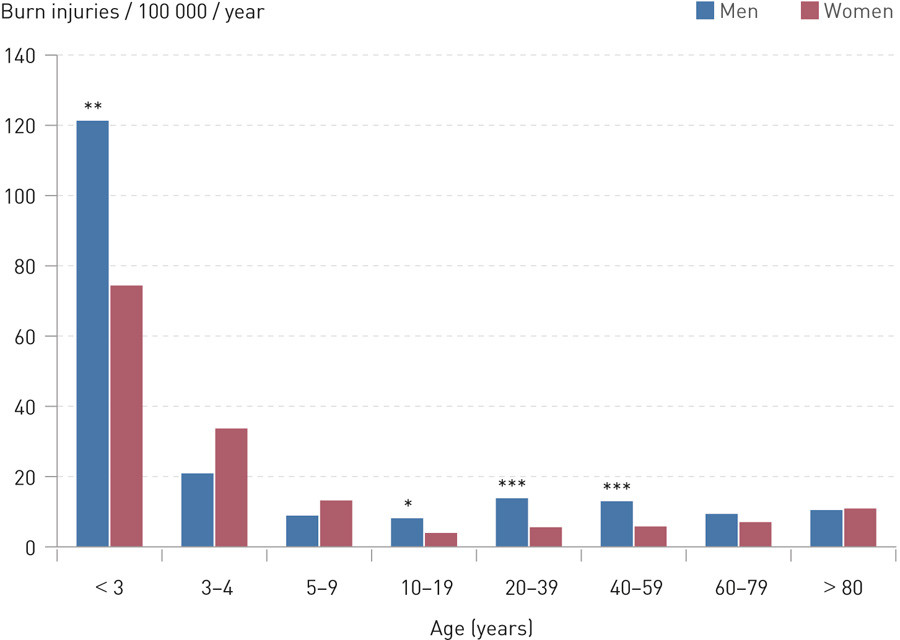 Figure 2  Age-adjusted incidence of patients with burn injuries admitted to Norwegian hospitals in 2012. Based on data&hellip;