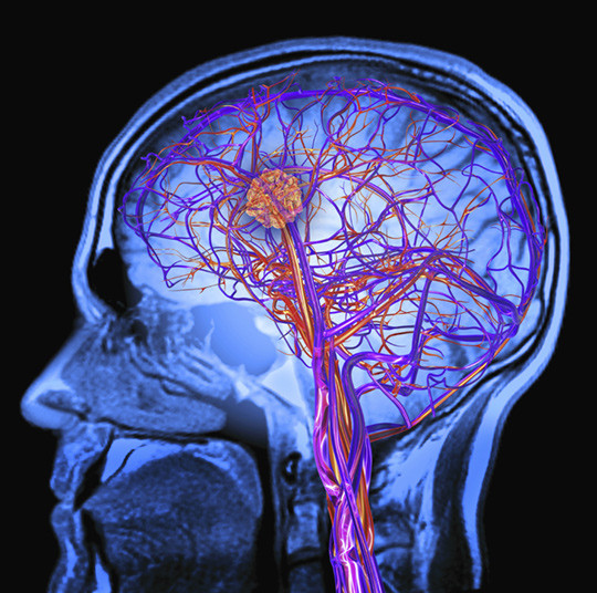 Illustrasjonsfoto: Science Photo Library