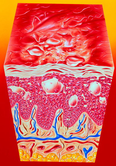 Eksem. Illustrasjon: Science Photo Library