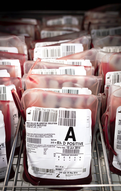 Illustrasjonsfoto: Science Photo Library