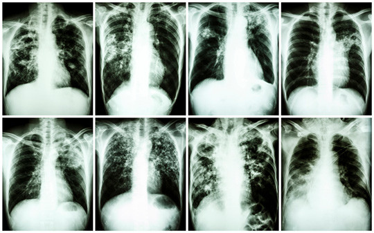 Illustrasjonsfoto: Thinkstock