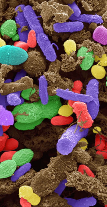 Elektronmikroskopi av forskjellige bakterier funnet i en avf&oslash;ringspr&oslash;ve. Foto: Science Photo Library