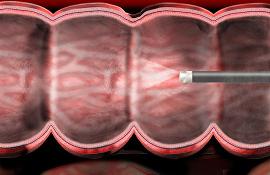 Illustrasjon: Science Photo Library