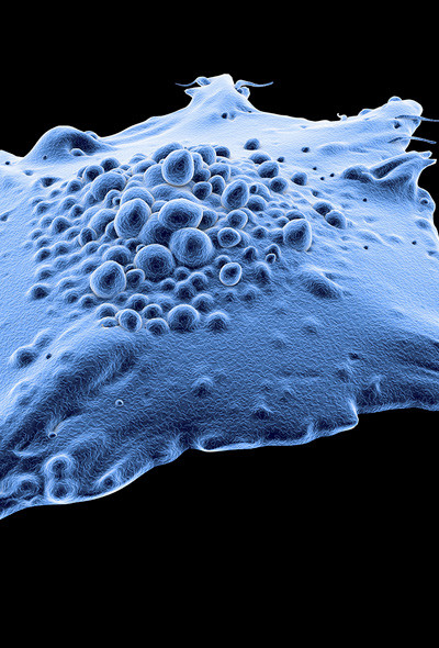 Kreftcelle. Illustrasjon: Science Photo Library