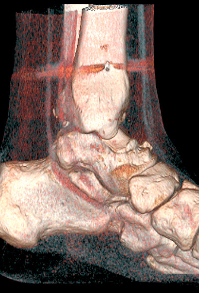 Illustrasjonsfoto: Science Photo Library