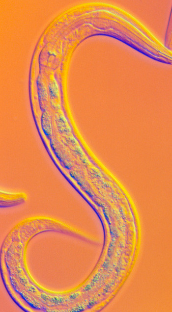 Rundormen Caenorhabditis elegans. Foto: Science Photo Library
