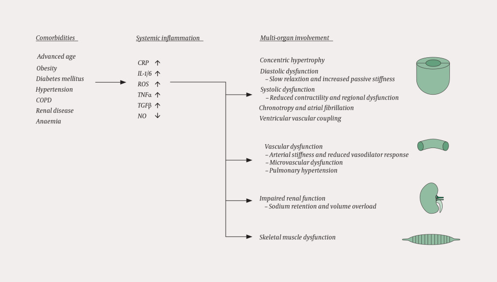 Figure 1 Factors that contribute to heart failure with preserved ejection fraction, including systolic dysfunction, abnormal&hellip;