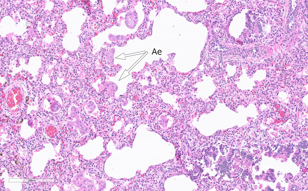 Figure 3 Haematoxylin and eosin-stained lung section with amniotic epithelium (Ae) in the intra-alveolar space