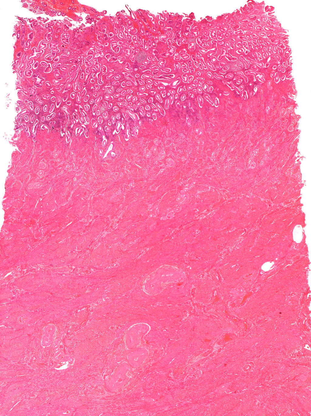 Lysmikroskopibilde av del av livmor hos menneske. Foto: Science Photo Library