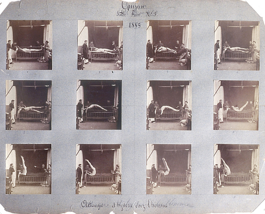 "Attaque d'hysterie chez l'homme" &ndash; photo series from 1885 featuring a patient at La Salp&ecirc;tri&egrave;re hospital in Paris. Photo:&hellip;