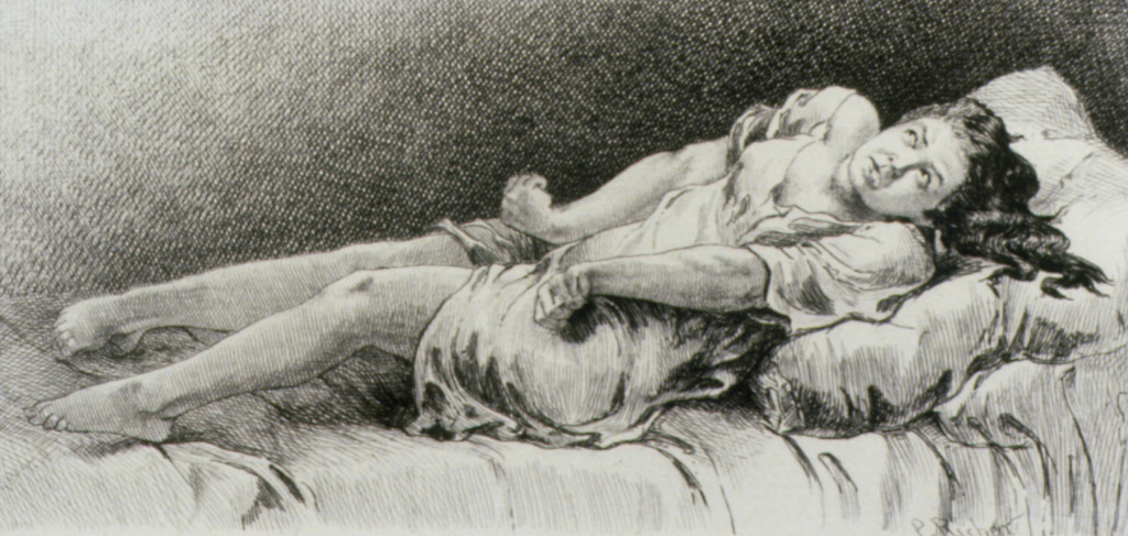 The first stage of epilepsy &ndash; paralysis and convulsion. Etching after a drawing by Paul Richer in his "Etudes cliniques sur&hellip;