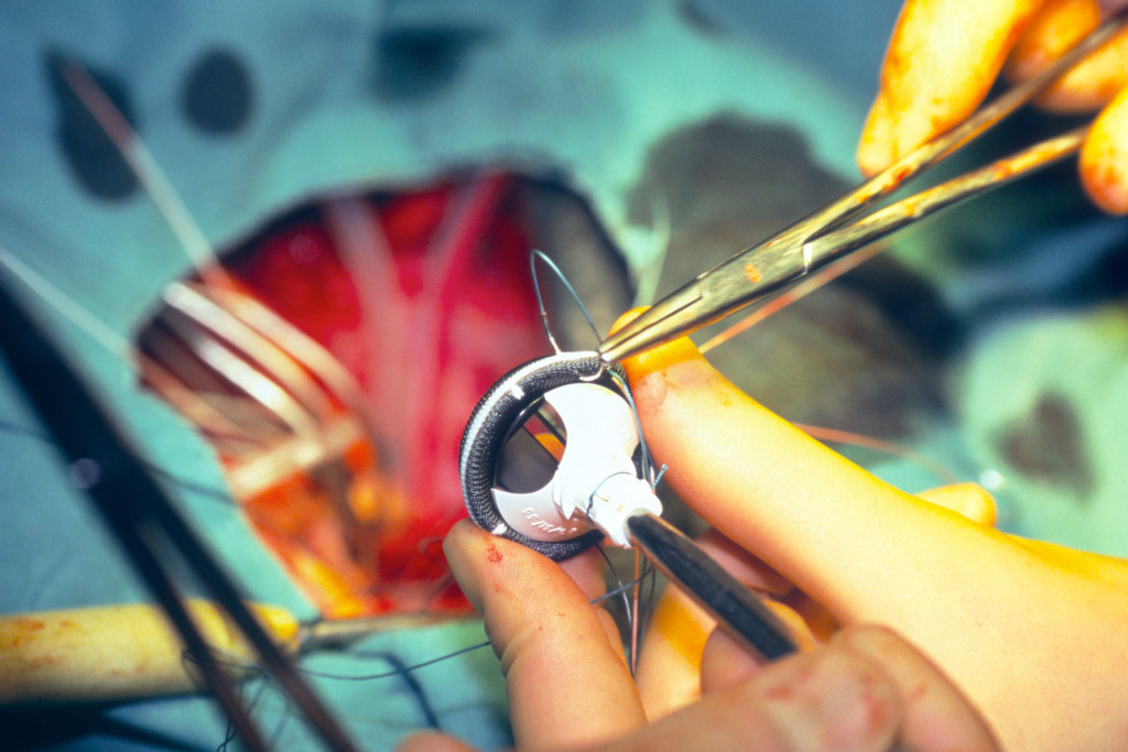 Festing av kunstig hjerteklaff. Illustrasjonsfoto: Science Photo Library/NTB scanpix