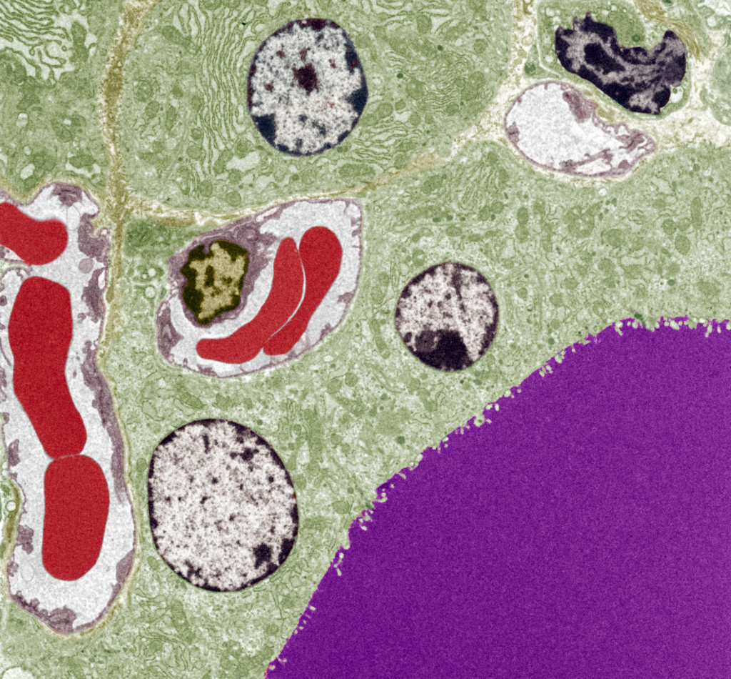 Follikkelcelle i thyreoidea. Lagring av tyroksin skjer i det lilla feltet, de gr&aring; og svarte strukturene er cellekjerner&hellip;