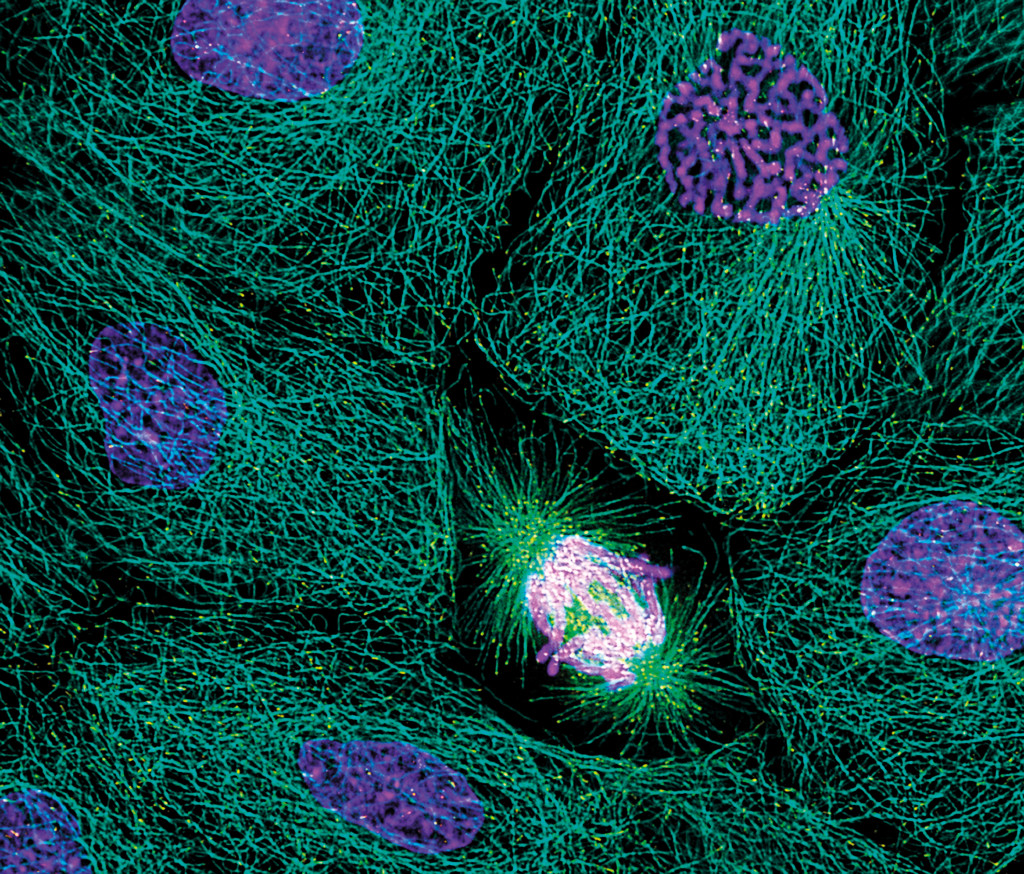 Cellemitose, her i anafasen. Illustrasjonsfoto: Science photo library/NTB Scanpix.