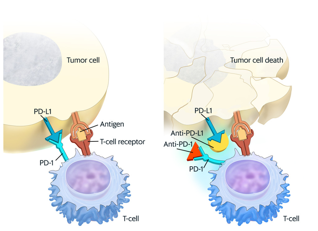Figure 1 When PD-L1 (programmed cell death ligand 1) on the tumour cell binds to the PD-1 receptor (programmed cell death 1&hellip;