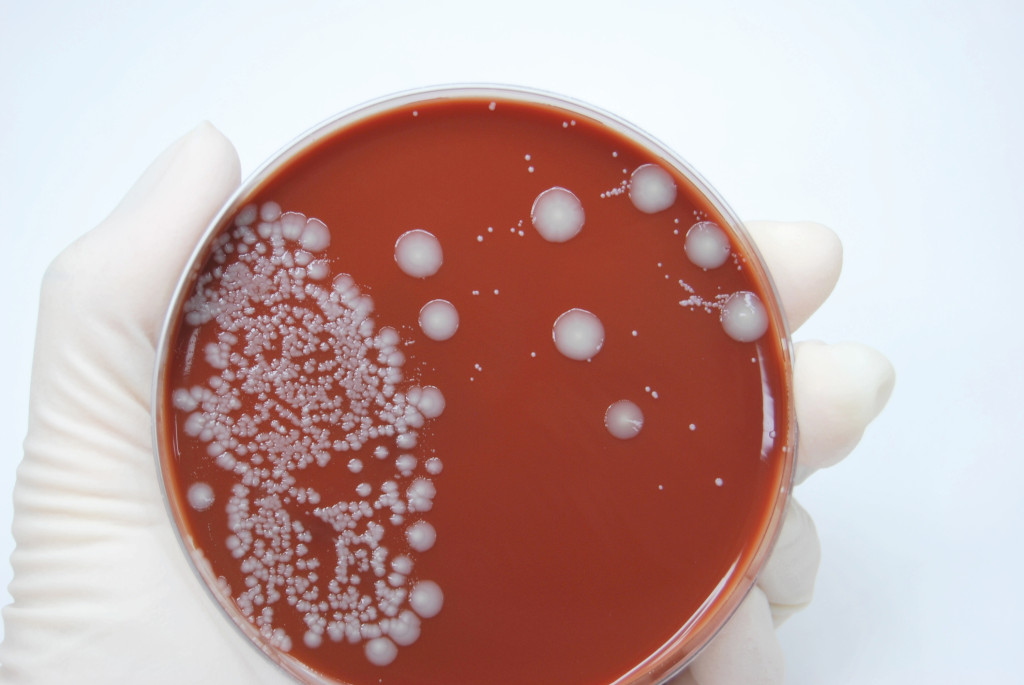 Illustrasjon: Linde1/iStock