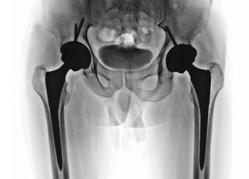 Illustrasjon: Sittithat Tangwitthayaphum / iStock